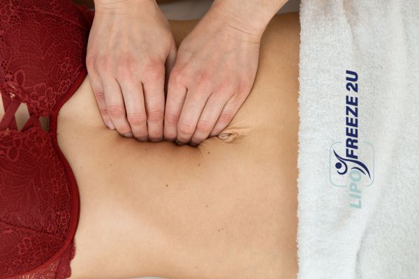 diastasis recti treatment Suffolk