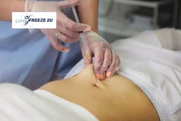 Fat Dissolving Injections Suffolk & Weight loss medication