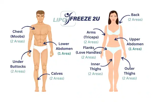 Areas you can have fat freezing treatment Suffolk
