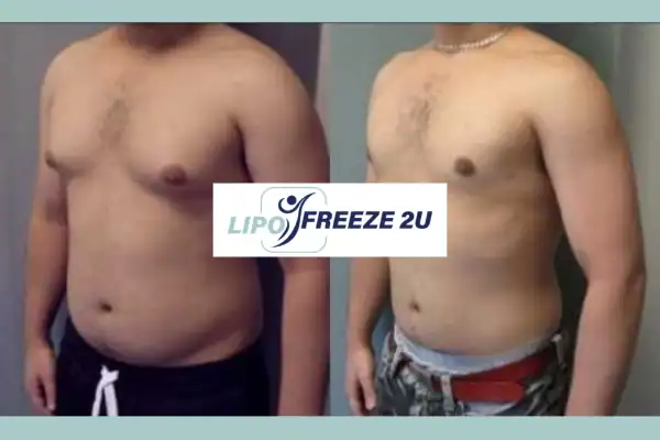 How Long Does It Take to See Results Suffolk?