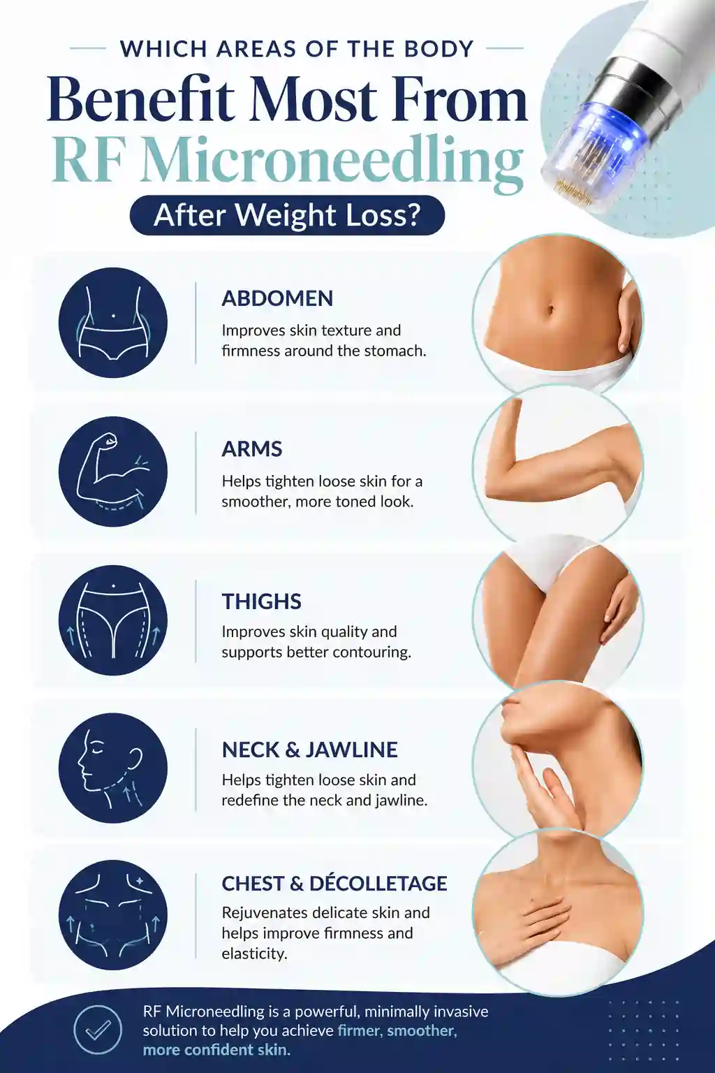 Which Areas of the Body Benefit Most From RF Microneedling After Weight Loss Suffolk